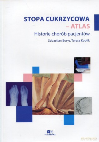 Stopa cukrzycowa - atlas - Sebastian Borys, Teresa Koblik [KSIĄŻKA]