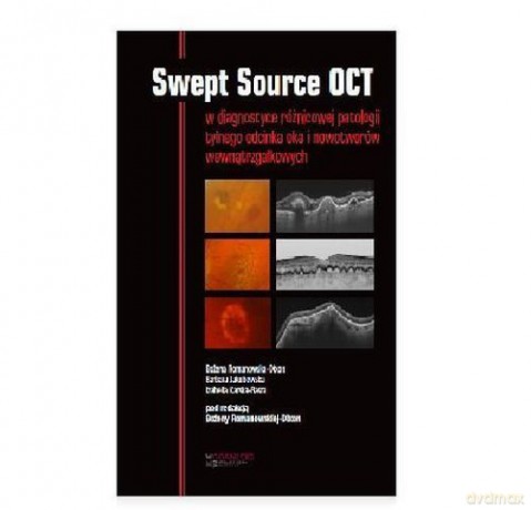 Swept Source OCT - Bożena Romanowska-Dixon, Barbara Jakubowska [KSIĄŻKA]