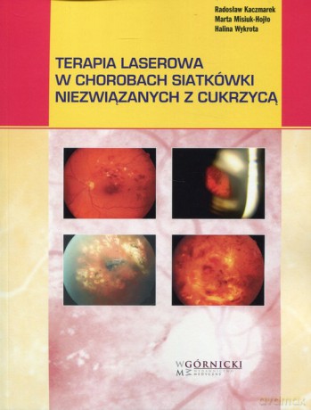 Terapia laserowa w chorobach siatkówki niezwiązanych z cukrzycą - Radosław Kaczmarek, Marta Misiuk-Hojło [KSIĄŻKA]