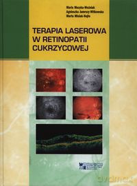 Terapia laserowa w retinopatii cukrzycowej - Maria Muzyka-Woźniak, Agnieszka Jamrozy-Witkowska [KSIĄŻKA]