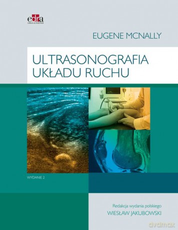 Ultrasonografia układu ruchu - E.G. McNally [KSIĄŻKA]