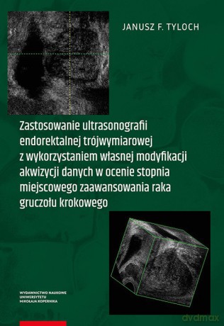 Zastosowanie ultrasonografii endorektalnej trójwymiarowej - Janusz Tyloch [KSIĄŻKA]