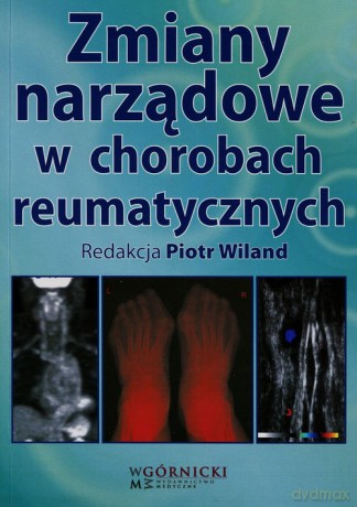 Zmiany narządowe w chorobach reumatycznych [KSIĄŻKA]