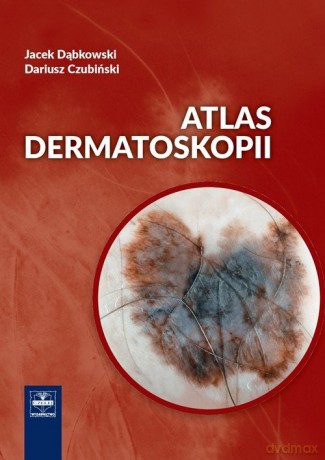 Atlas dermatoskopii - Jacek Dąbkowski, Dariusz Czubiński [KSIĄŻKA]