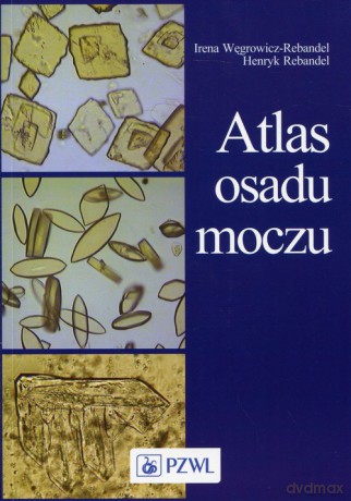 Atlas osadu moczu - Irena Węgrowicz-Rebandel, Hanryk Rebandel [KSIĄŻKA]