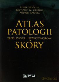 Atlas patologii złośliwych nowotworów skóry - Leszek Woźniak, Krzysztof W. Zieliński [KSIĄŻKA]