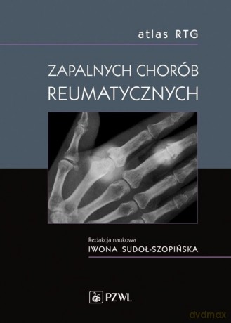 Atlas RTG zapalnych chorób reumatycznych [KSIĄŻKA]