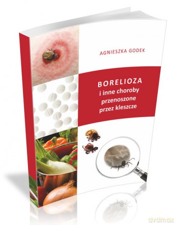 Borelioza i inne choroby przenoszone przez kleszcze - Agnieszka Godek [KSIĄŻKA]