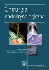 Chirurgia endokrynologiczna - Stanisław Cichoń, Lech Poloński [KSIĄŻKA]