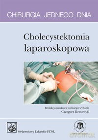 Chirurgia jednego dnia Cholecystektomia laparoskopowa [KSIĄŻKA]