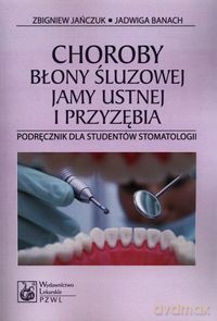 Choroby błony śluzowej jamy ustnej i przyzębia - Zbigniew Jańczuk, Jadwiga Banach [KSIĄŻKA]