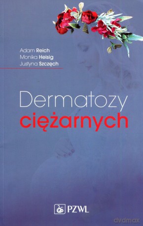 Dermatozy ciężarnych - Adam Reich, Monika Heisig [KSIĄŻKA]