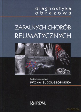 Diagnostyka obrazowa zapalnych chorób reumatycznych - Iwona Sudoł-Szopińska [KSIĄŻKA]