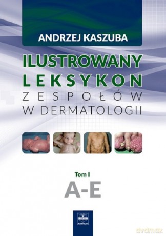Ilustrowany leksykon zespołów w dermatologii (Tom 1) A-E - Andrzej Kaszuba [KSIĄŻKA]
