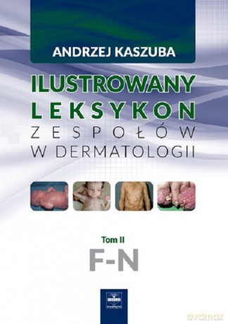 Ilustrowany leksykon zespołów w dermatologii (Tom 2) F-N - Andrzej Kaszuba [KSIĄŻKA]