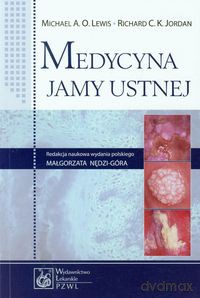 Medycyna jamy ustnej - Michael A.O. Lewis, Richard C.K. Jordan [KSIĄŻKA]
