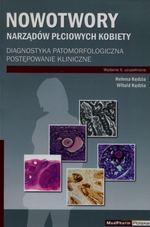 Nowotwory narządów płciowych kobiety - Helena Kędzia, Witold Kędzia [KSIĄŻKA]
