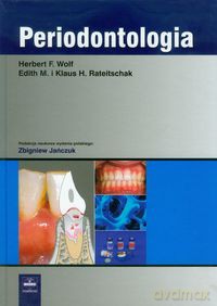 Periodontologia - Herbert F. Wolf, Klaus H. Rateitschak [KSIĄŻKA]