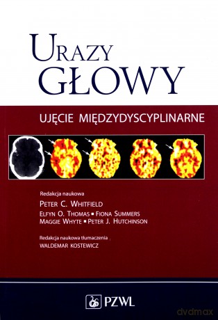 Urazy głowy [KSIĄŻKA]