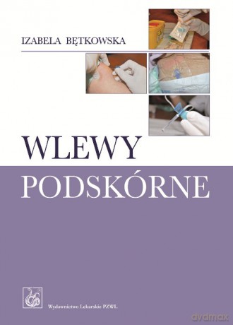 Wlewy podskórne - Izabela Bętkowska [KSIĄŻKA]