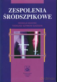 Zespolenia śródszpikowe [KSIĄŻKA]