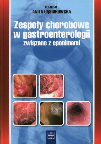 Zespoły chorobowe w gastroenterologii związane z eponimami [KSIĄŻKA]