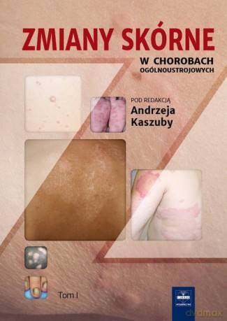 Zmiany skórne w chorobach ogólnoustrojowych (Tom 1) [KSIĄŻKA]