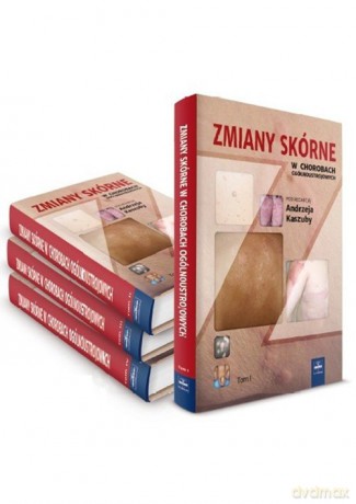 Zmiany skórne w chorobach ogólnoustrojowych (Tom 4) - Andrzej Kaszuba [KSIĄŻKA]