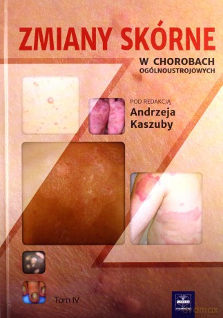 Zmiany skórne w chorobach ogólnoustrojowych (Tom 4) - Andrzej Kaszuba [KSIĄŻKA]